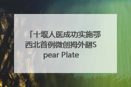 十堰人医成功实施鄂西北首例微创拇外翻Spear Plate髓内板矫形术